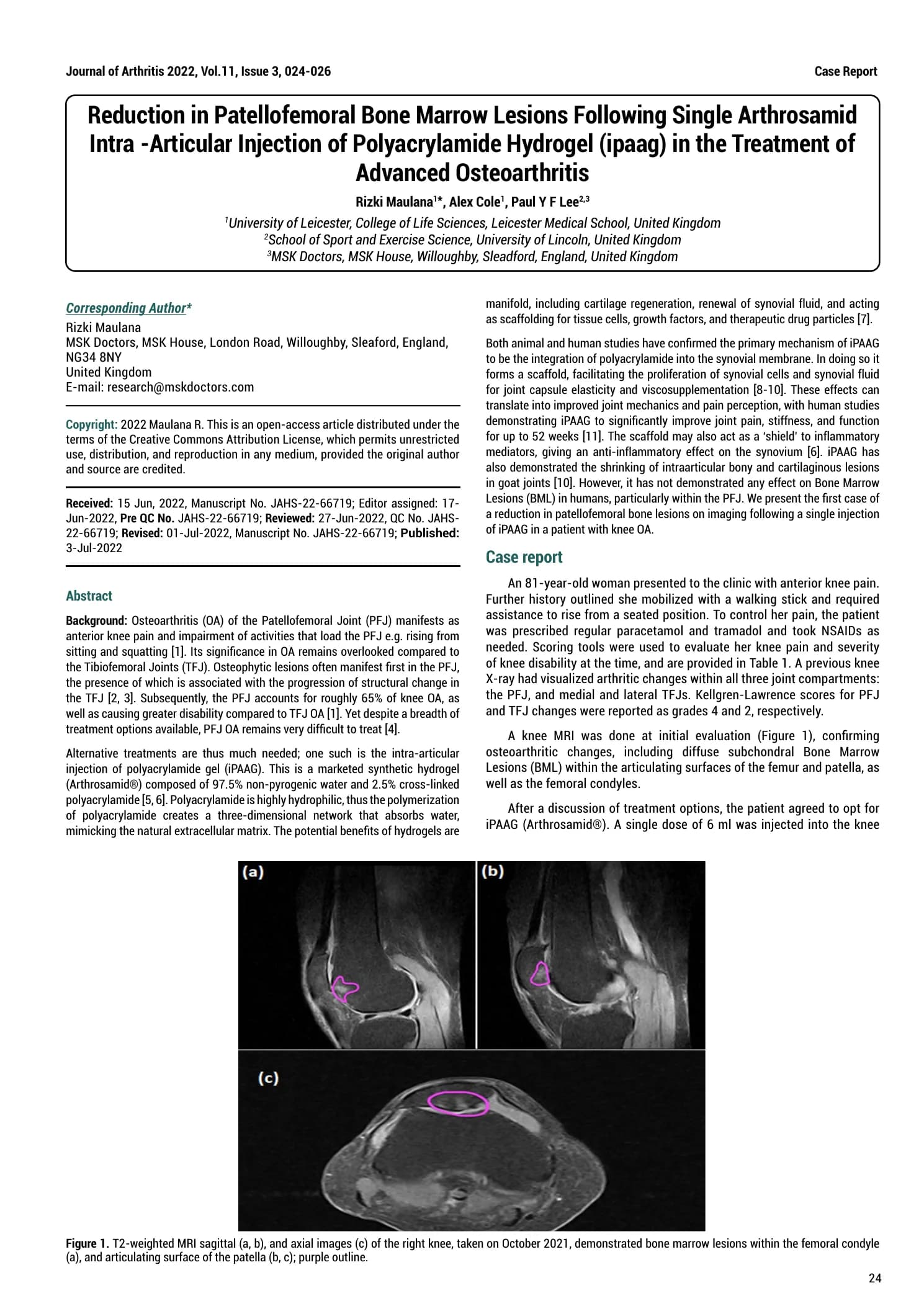 Publication cover: Maulana, Cole & Lee (2022): patellofemoral MRI case report